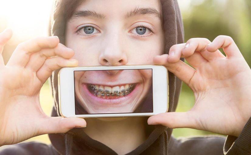 Teenage boy holding smartphone up to his mouth displaying a smile with braces.